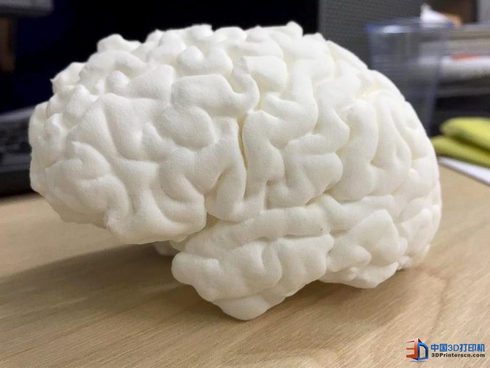 未來醫療行業 3D打印技術融入其中的四種方式
3D醫療行業,3D打印心臟,3D打印大腦,3D打印應用,3D打印領域,3D打印和醫療的關系,3D打印平臺,3D打印服務,3d打印企業服務平臺