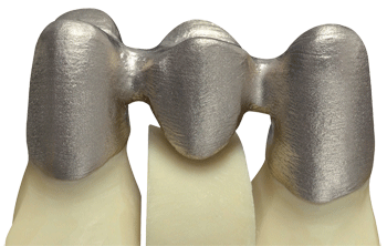 德國率先引入3D打印牙齒技術(shù) 全程體驗“無痛”種牙-e鍵打印|3D打印服務(wù)
3d打印牙齒,3D打印種牙,無痛種牙,3D打印平臺,3D打印服務(wù),南京哪里有3D打印,南京3D打印廠家,南京3D打印服務(wù)