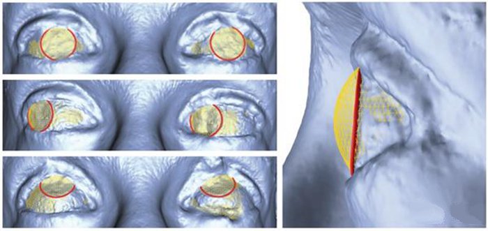 3D打印新技術(shù) 迪斯尼用照片重建繪制3D眼部立體圖_e鍵3D打印服務(wù) 3D打印新技術(shù) 迪斯尼用照片重建繪制3D眼部立體圖_e鍵3D打印服務(wù)