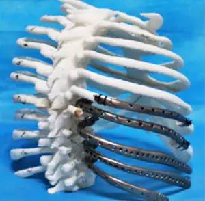 第四軍醫大學精彩分享個性化醫療3D打印的實戰案例與研究成果 第四軍醫大學精彩分享個性化醫療3D打印的實戰案例與研究成果