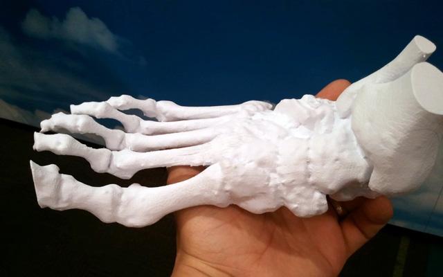 3d打印應用領域之醫(yī)療應用_e鍵打印服務公司 3d打印應用領域之醫(yī)療應用_e鍵打印服務公司