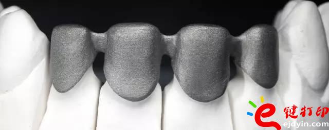 醫療輔助器械的變革之路 3d打印義齒(假牙)前景無限 勢在必行_醫療設備器械3d模型打印平臺