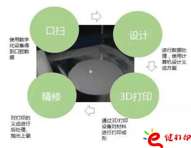 醫療輔助器械的變革之路 3d打印義齒(假牙)前景無限 勢在必行_醫療設備器械3d模型打印平臺