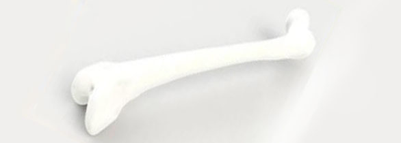 股骨金屬植入物2