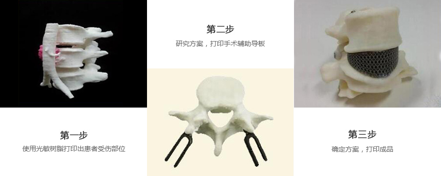 腰椎金屬植入物3d打印制作流程